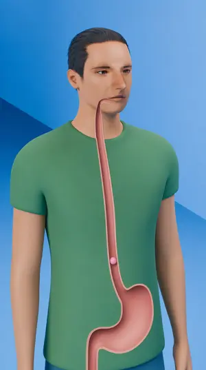 3D explainer: a cutaway shows swallowed gum on its way to a man's stomach.