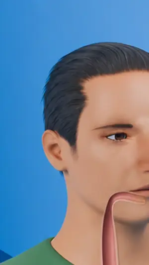 3D explainer, close-up: the gum at the top of the throat.